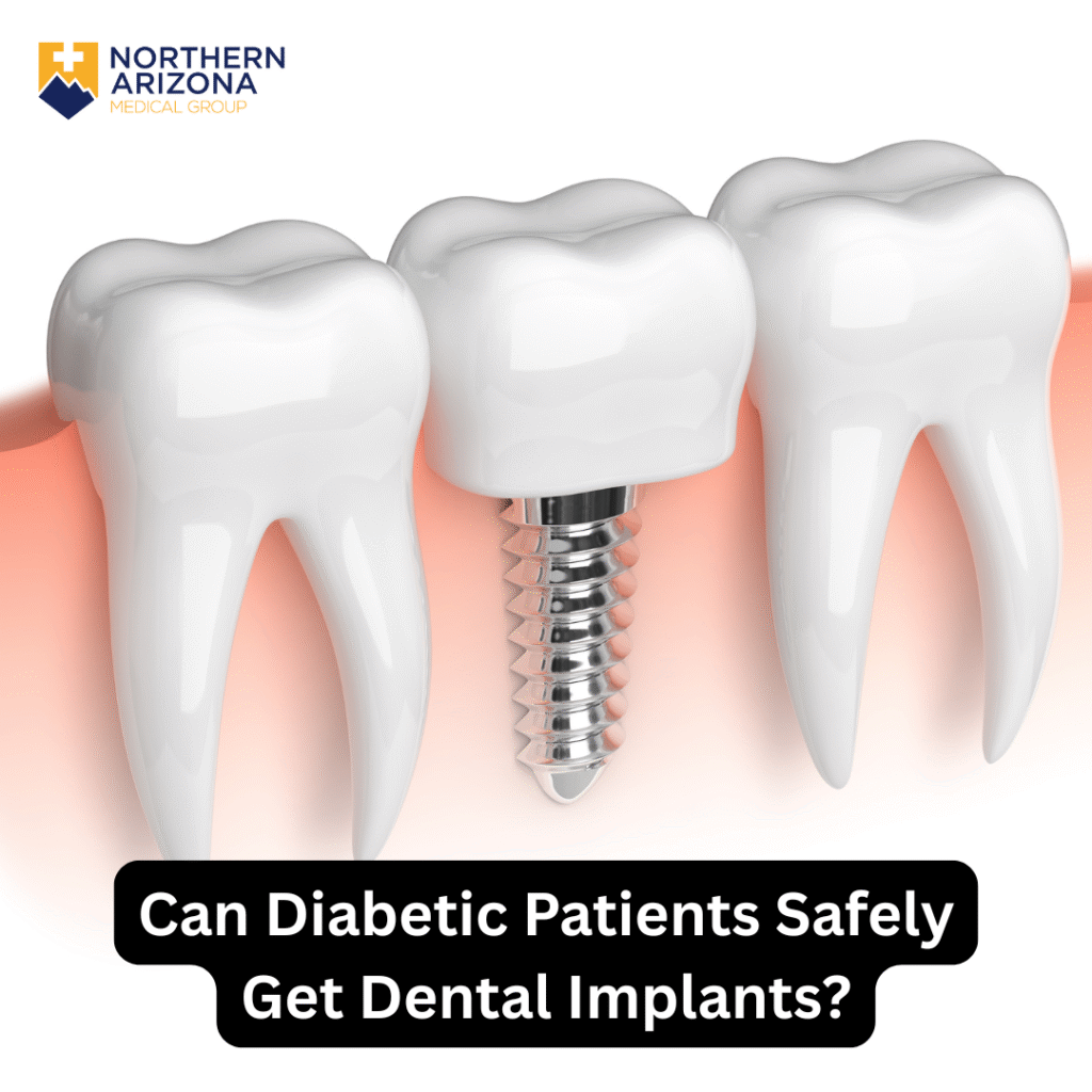Can Diabetic Patients Safely Get Dental Implants?