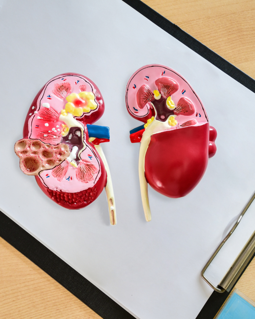 Chronic Kidney Disease Treatment in Kingman, AZ